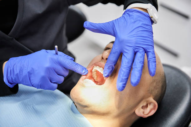 Best Chipped Tooth Repair Near Me  in Pasadena, CA